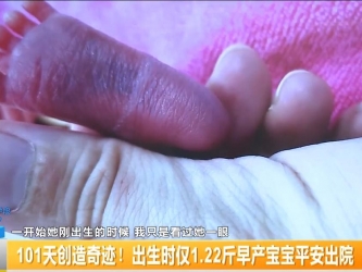 【视频新闻 】101天创造奇迹！出生时仅1.22斤早产宝宝平安