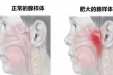 为啥总感觉孩子越长越丑了？只因一个坏习惯