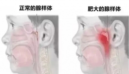 為啥總感覺孩子越長越丑了？只因一個壞習慣