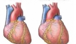 孩子突然反復(fù)嘔吐、抽搐伴發(fā)紺，原來是心臟病作怪！