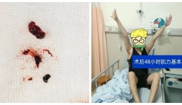 25歲小伙腦卒中！警惕這個(gè)低齡化的“刺客”