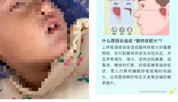 孩子腺樣體肥大，到底要不要切？