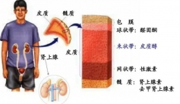 年輕男子手麻、腳麻、血壓高……原是這種“瘤”導(dǎo)致！