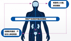 一喝水就想上廁所？可能您的膀胱“過度活動”了！