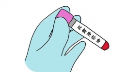 精準(zhǔn)治療，找準(zhǔn)致敏“真兇”——塵螨組分蛋白檢測