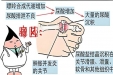 痛风是否影响精液质量，痛风患者备孕期间该注意什么？