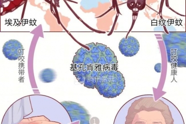 基孔肯雅热对孕妈和宝宝有哪些风险？防护攻略来了！