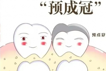 总是反复补牙？给孩子的乳磨牙戴个“安全帽”！