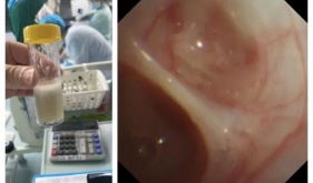 6岁女孩“感冒”后，喘不上气，命悬一线……