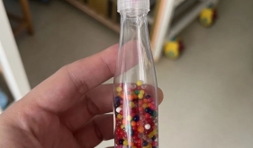 1岁宝宝呕吐1周，竟是“网红玩具”在十二指肠安了家……