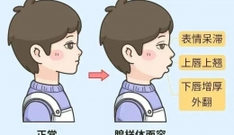 孩子越长越丑，“隐形杀手”竟是它？