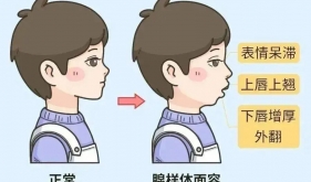 孩子越长越丑，“隐形杀手”竟是它？