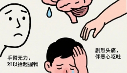 80、90后已成中风高发人群！卒中为何盯上年轻人