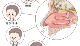 孩子换季鼻炎闹，试试中医小妙招！