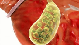 查出了胆囊结石，切还是保？