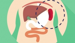 从“钥匙孔”里切除巨大脾脏！20岁重型地贫女子迎来新生