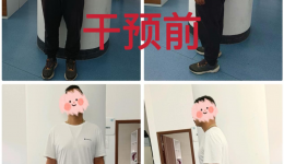 男子3个月减23斤！节后减重，选对方法比努力更重要！