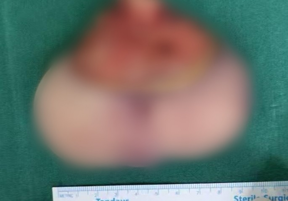 孕期产检发现腹中胎儿有条“尾巴”，夫妻俩慌了，结果......