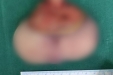 孕期产检发现腹中胎儿有条“尾巴”，夫妻俩慌了，结果......