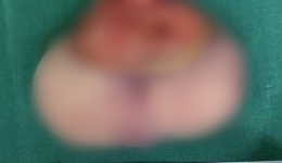 孕期产检发现腹中胎儿有条“尾巴”，夫妻俩慌了，结果......