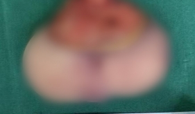 孕期产检发现腹中胎儿有条“尾巴”，夫妻俩慌了，结果......