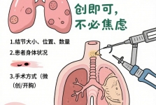 肺上长了结节，为什么没感觉？出现这3种症状才危险