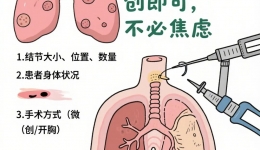 肺上长了结节，为什么没感觉？出现这3种症状才危险