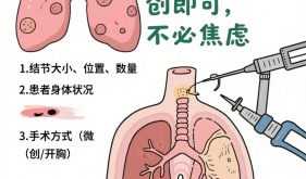 肺上长了结节，为什么没感觉？出现这3种症状才危险