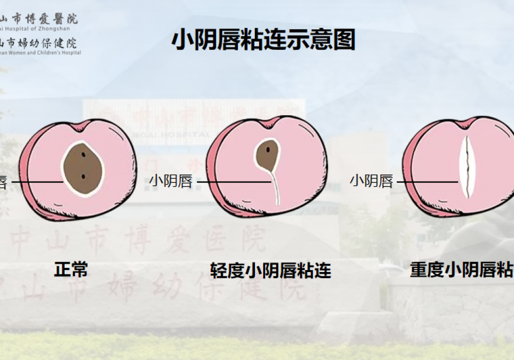 3岁女孩得了妇科病 ？女宝家长一定要懂的私处“小秘密”