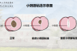 3岁女孩得了妇科病 ？女宝家长一定要懂的私处“小秘密”