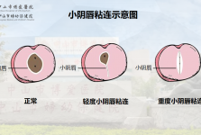 3岁女孩得了妇科病 ？女宝家长一定要懂的私处“小秘密”
