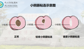 3岁女孩得了妇科病 ？女宝家长一定要懂的私处“小秘密”