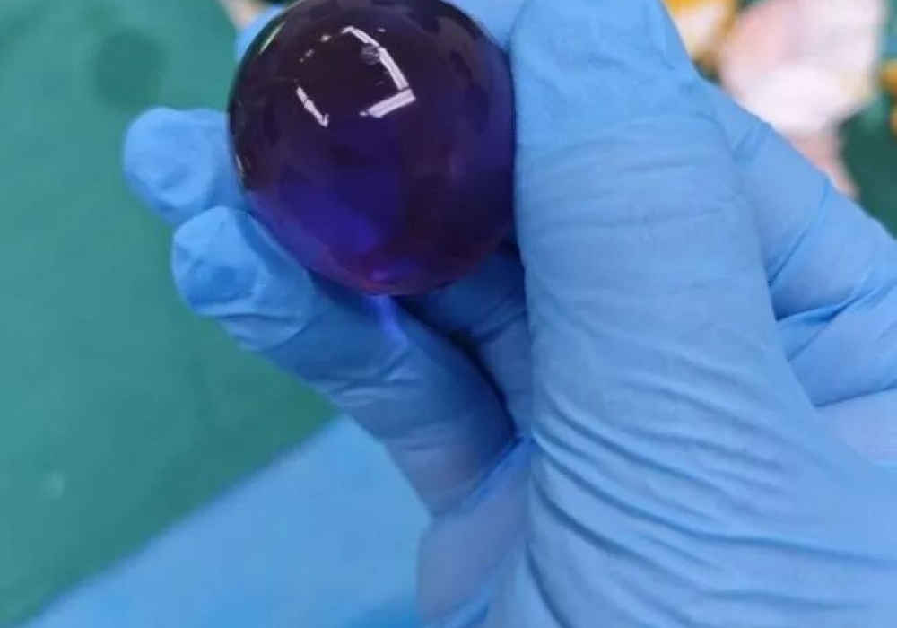 1岁8个月宝宝呕吐不止，肚里竟取出3cm“水宝宝”！