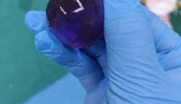 1岁8个月宝宝呕吐不止，肚里竟取出3cm“水宝宝”！