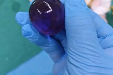 1岁8个月宝宝呕吐不止,肚里竟取出3cm“水宝宝”!