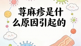 皮肤起风团、喉咙发紧，千万别当普通过敏硬扛！