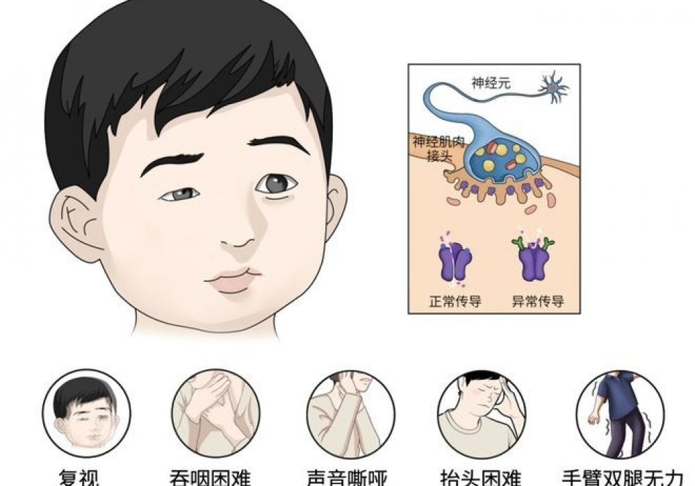 孩子眼睛一大一小，睡一觉又恢复？别把“神经求救信号”当疲劳！