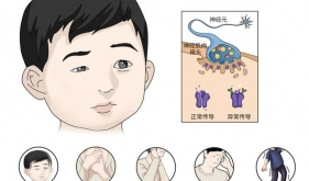 孩子眼睛一大一小，睡一觉又恢复？别把“神经求救信号”当疲劳！