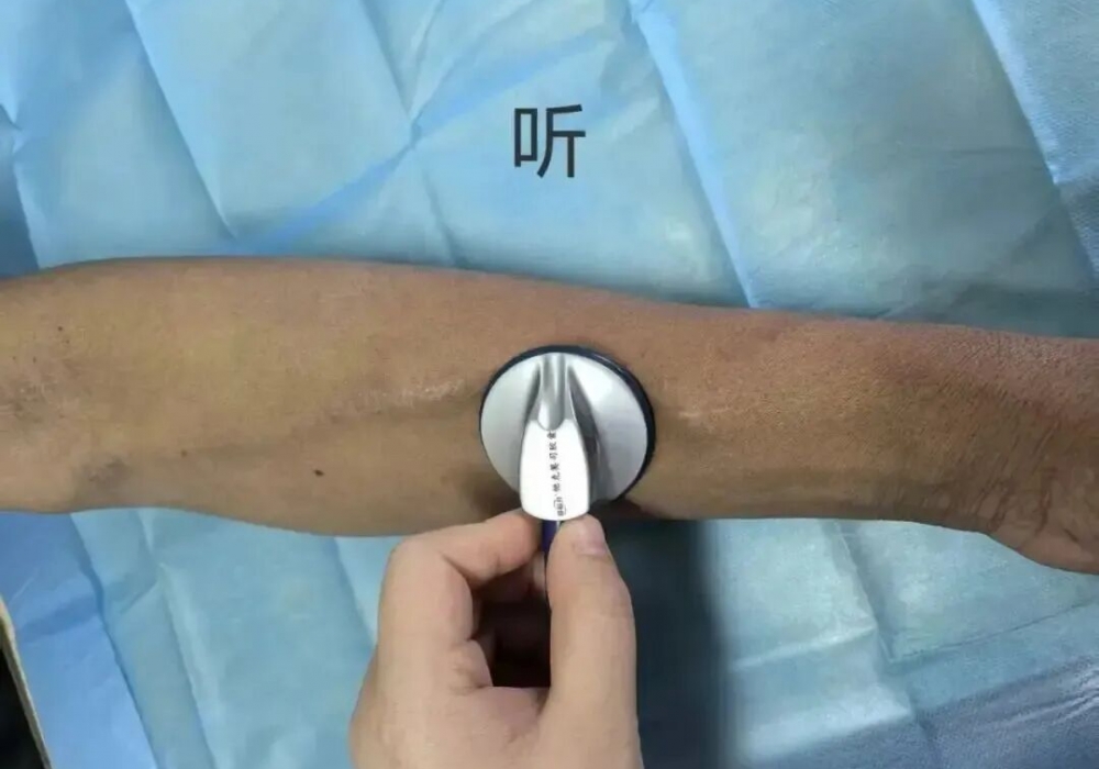 摸一下手臂就能救命？这3个动作，透析患者每天必须做